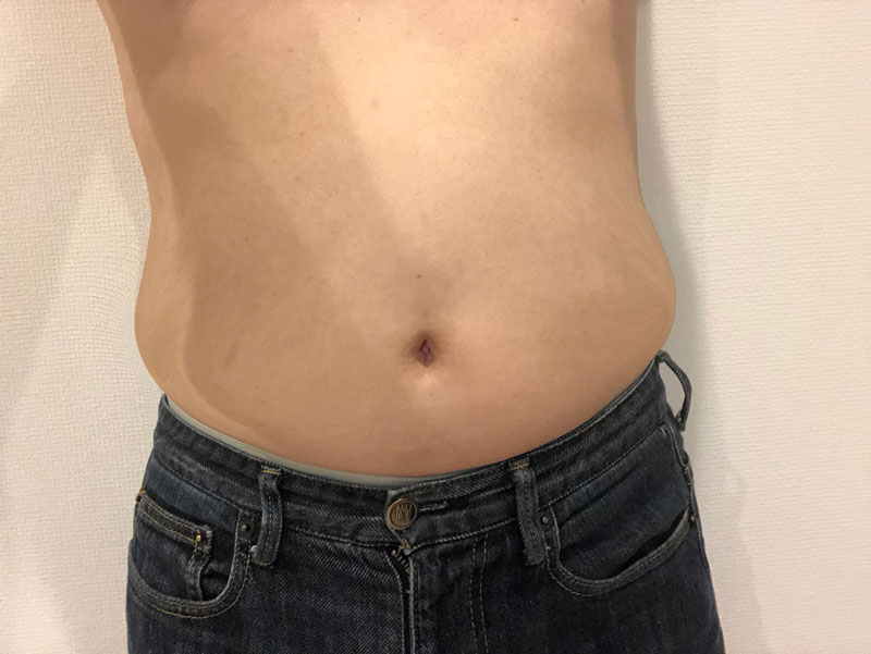 【ダイエット開始】ナイシトールよりシボヘール!ポッコリお腹の脂肪を落とす